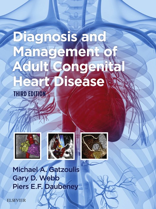 Diagnosis and Management of Adult Congenital Heart Disease E ... - cover