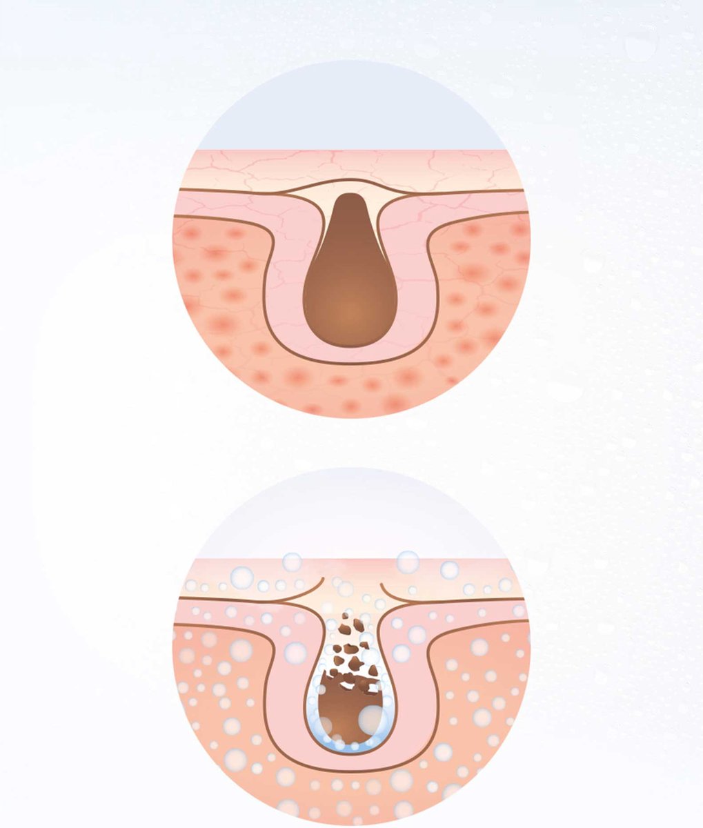 Lanaform - Facial Care thumbnail 4