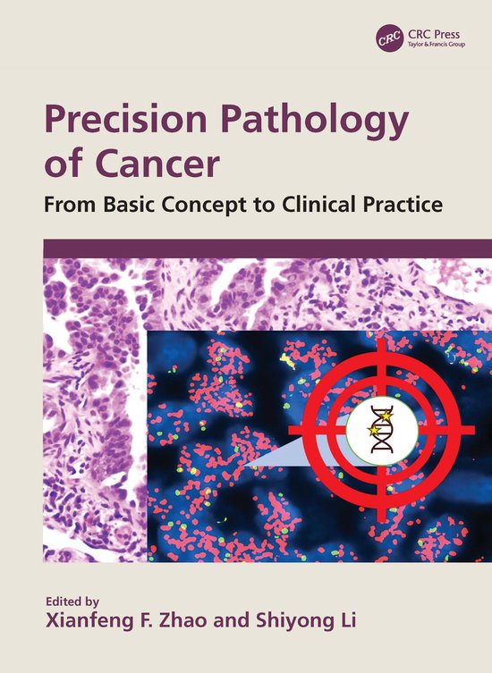 Precision Pathology of Cancer | 9781032844862 | Boeken | bol
