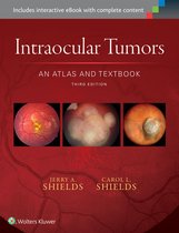 Intraocular Tumors An Atlas & Textbook