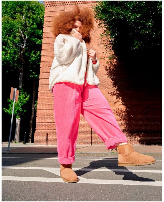 Een vrouw draagt een bruine UGG laars aan haar rechtervoet terwijl ze op een zebrapad staat.
