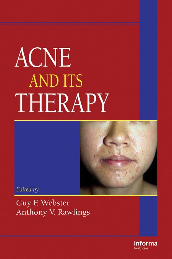 Basic and Clinical Dermatology - Acne and Its Therapy - cover