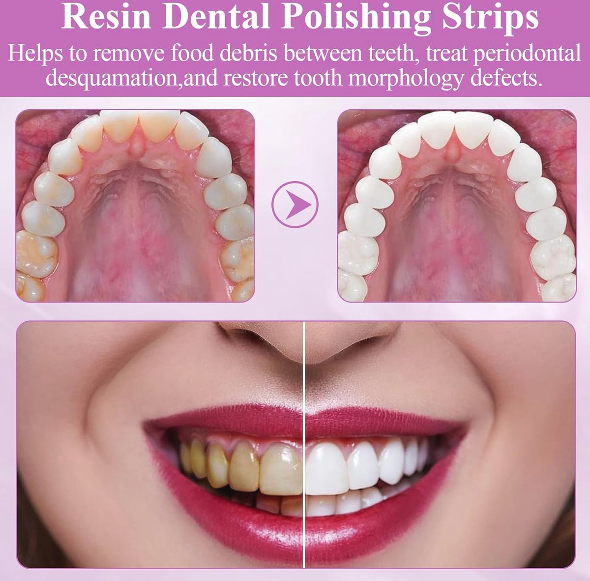 Tandheelkundige polijst- en schuurstrips | Basiq Dental Tandheelkundige polijst- en schuurstrips | Basiq Dental