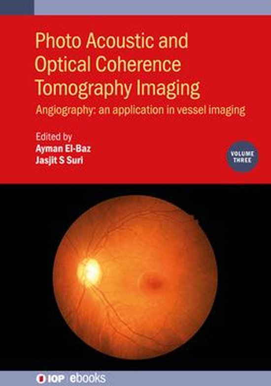 IOP ebooks - Photo Acoustic and Optical Coherence Tomography ... - cover