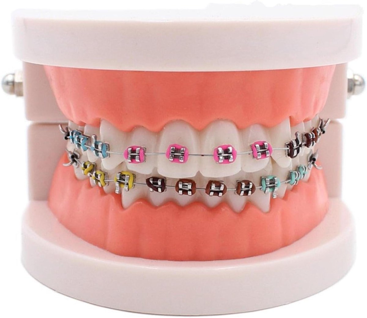 Tand Demonstratiemodel - Orthodontisch Model Tandenmodel - Tandheelkundige Educatie - Met Metalen Beugel - 8 cm - Niet gespecificeerd