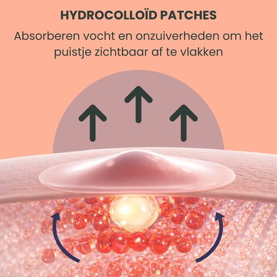 Illustratie van een hydrocolloïde patch die vocht en talg uit een puistje absorbeert.