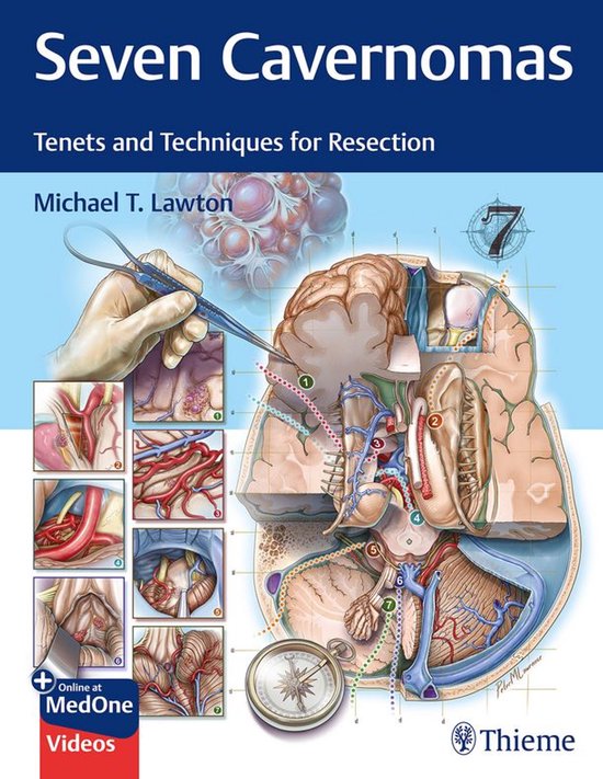 Seven Cavernomas - cover