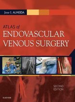 Atlas of Endovascular Venous Surgery E-Book