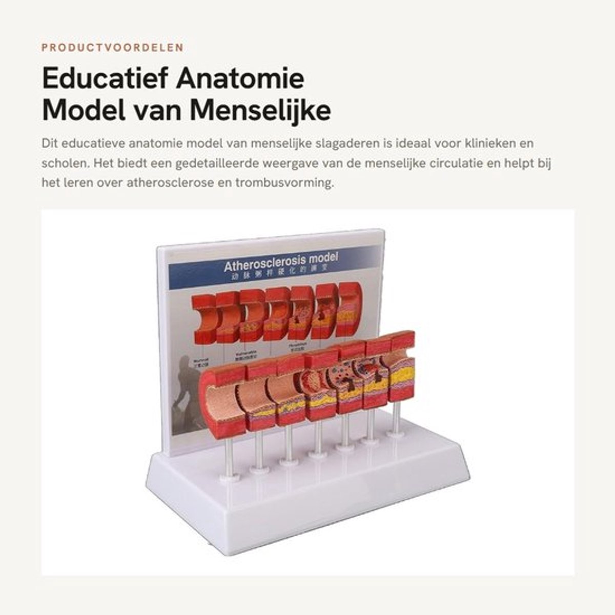 Slagader Model 7 Stuks - Anatomie Model - Educatief Hulpmiddel - PVC Materiaal - Communicatiemiddel Arts/Patiënt - Veilig en Betrouwbaar - Anatomiemodel