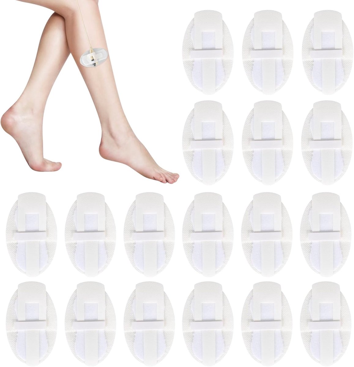 18 patches voor het bevestigen van de ureter Stabilisatie van de ureter Binnenband voor het bevestigen van de ureter - ShopVlot