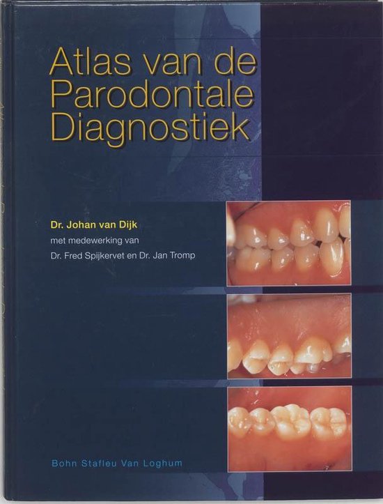 Cover van het boek 'Atlas van de parodontale diagnostiek + CD-ROM / druk 1' van J. van Dijk