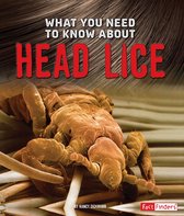 Focus on Health - What You Need to Know about Head Lice