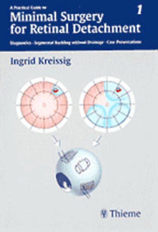 A Practical Guide to Minimal Surgery for Retinal Detachment, ... - cover