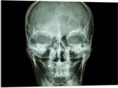 Acrylglas - Röntgenfoto van Mensenschedel - 80x60 cm Foto op Acrylglas (Met Ophangsysteem)