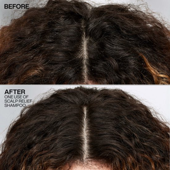 Redken Scalp Relief Dandruff Control Shampoo – Anti-roos shampoo voor de geïrriteerde hoofdhuid – 250 ml