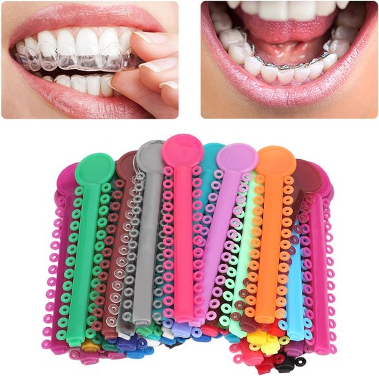 Kleurige orthodontische ligatuur elastieken - 40 stuks plastic ringen voor beugels en tandcorrectie — afbeelding 3