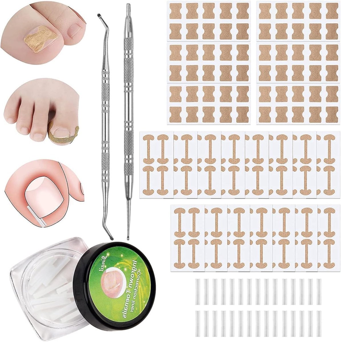Complete Pedicure Set met 152 Stukken voor Ingegroeide Teennagels, Inclusief Correctie-instrumenten, Vijl en Lifters voor Optimale Voetverzorging