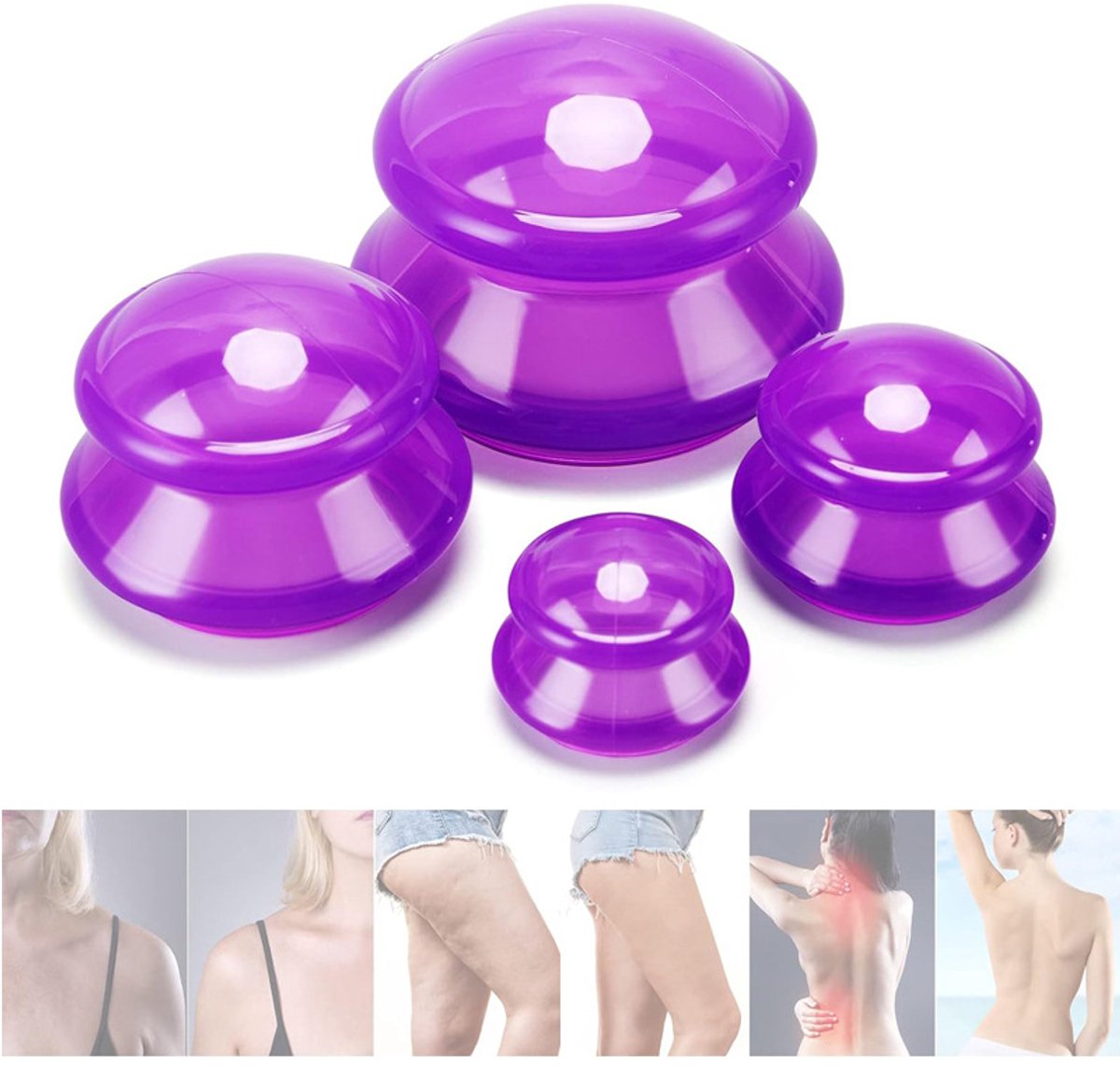 4-delige siliconen cupping-set – cupping set - cellulite cups - Cupping Cups - Professionele cupping-therapie – Volledige lichaamsmassage – Fasciale release – Paars