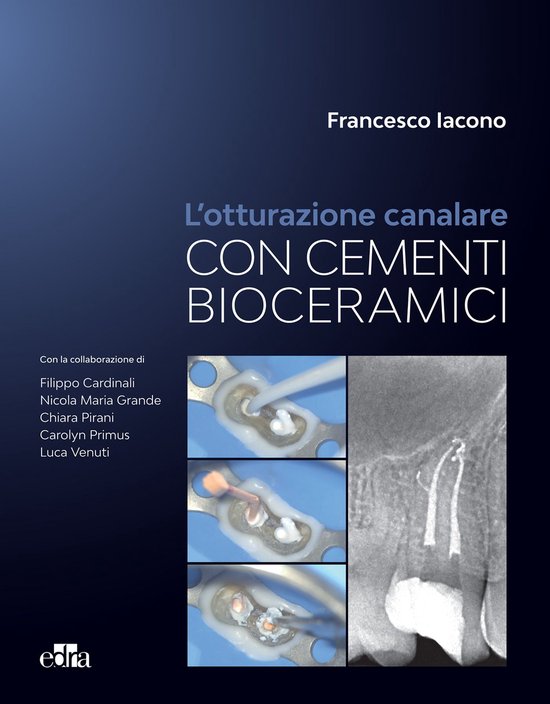 L'otturazione canalare con i cementi bioceramici - cover