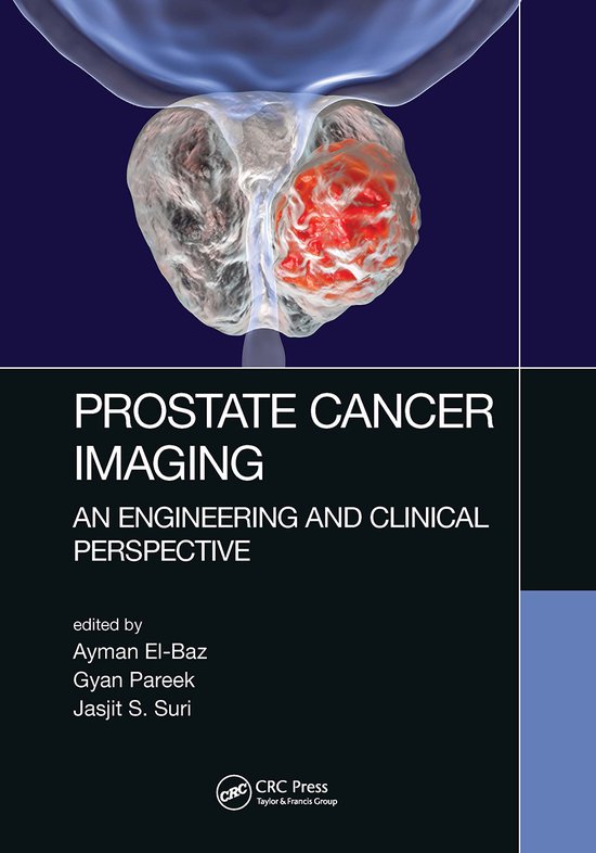 Prostate Cancer Imaging 9781032652412 Boeken