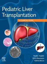 Pediatric Liver Transplantation E-Book