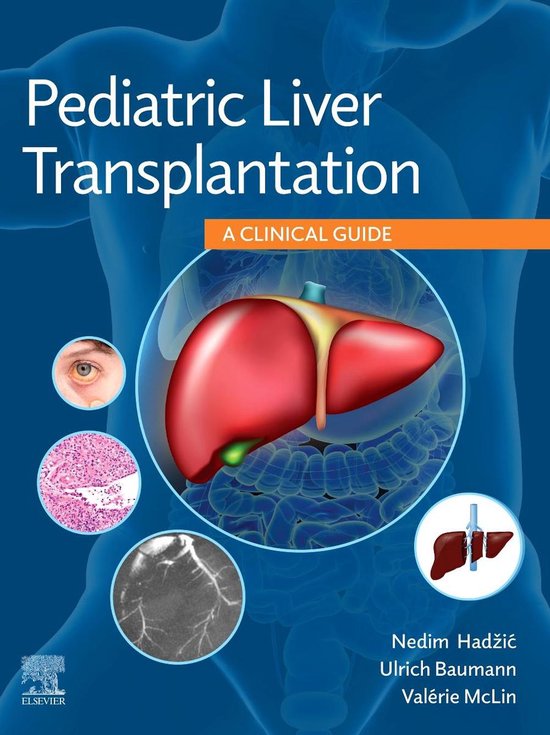 Pediatric Liver Transplantation - cover