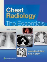 Essentials Series - Chest Radiology: The Essentials