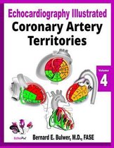 Coronary Artery Territories