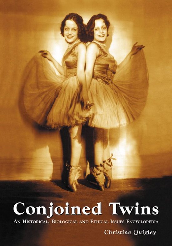 Conjoined Twins - cover