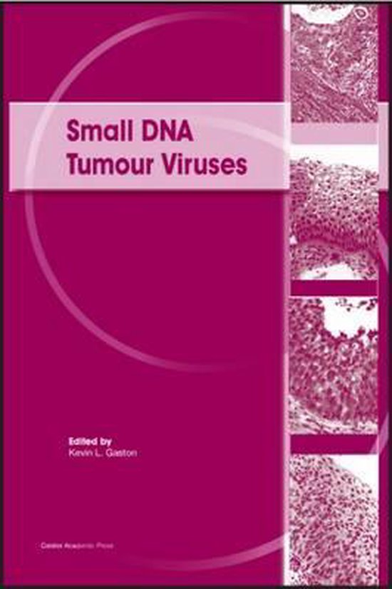 Foto: Small dna tumour viruses