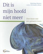 Omslag Dit is mijn hoofd niet meer