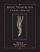 Spinal Arthroplasty