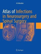 Atlas of Infections in Neurosurgery and Spinal Surgery