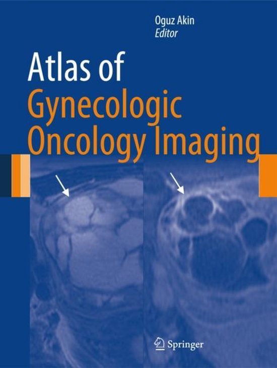 Foto: Atlas of gynecologic oncology imaging