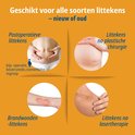 Overzicht van littekentypes behandeld door de siliconen pleister.