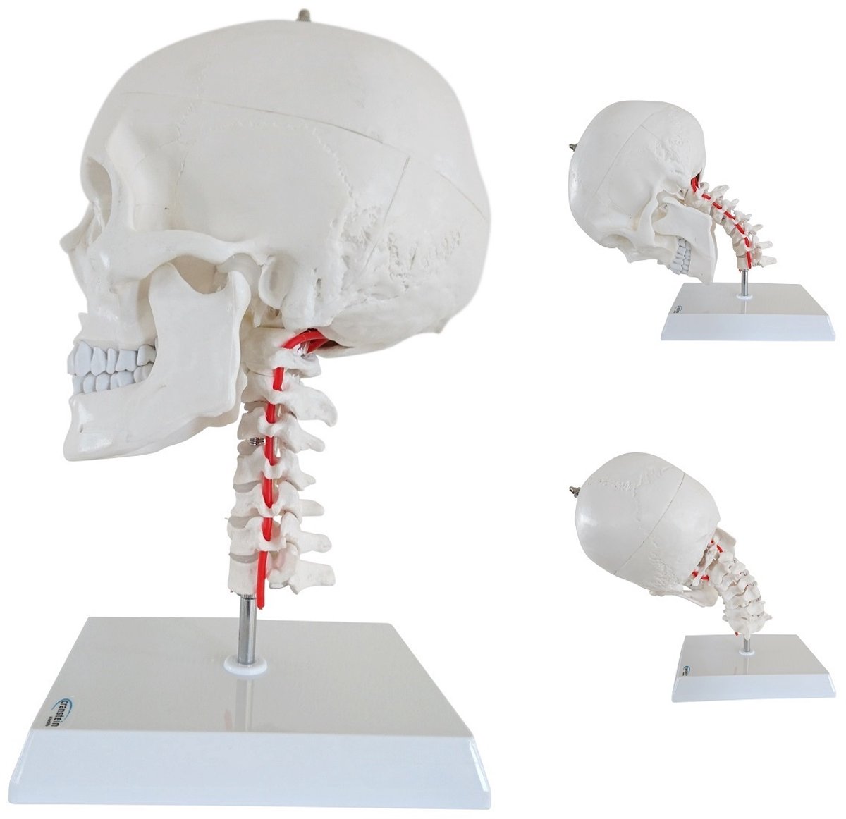 Cranstein Scientific anatomie model schedel met flexibele cervicale wervelkolom en bewegende onderkaak