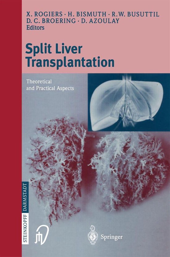 Split liver transplantation - cover