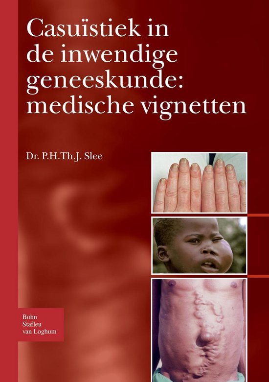 Dutch language eBook collection - Casuïstiek in de inwendige geneeskunde: medische vignetten