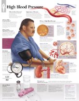 High Blood Pressure Laminated Poster