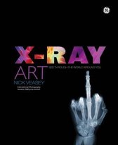X-Ray Art