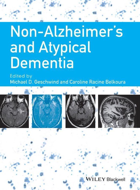 Non-Alzheimer's and Atypical Dementia - cover