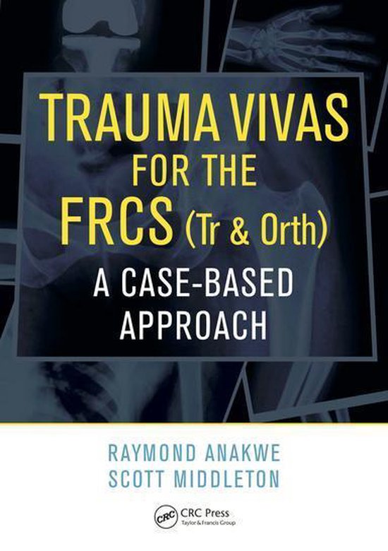 Trauma Vivas for the FRCS - cover
