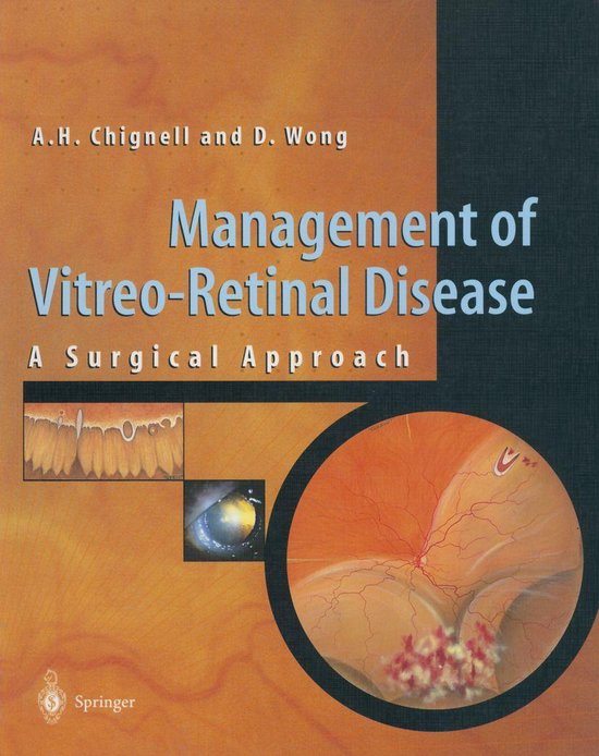 Management of Vitreo-Retinal Disease - cover