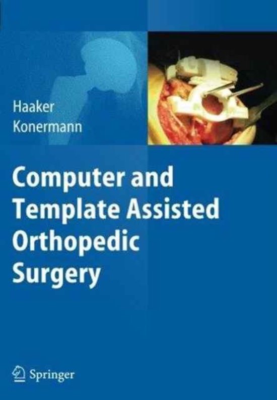 Computer and Template Assisted Orthopedic Surgery - cover