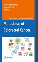 Cancer Metastasis - Biology and Treatment 14 - Metastasis of Colorectal Cancer