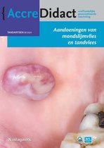 AccreDidact TA2021-4 -   Aandoeningen van mondslijmvlies en tandvlees