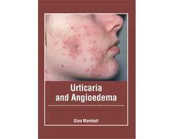 Urticaria and Angioedema
