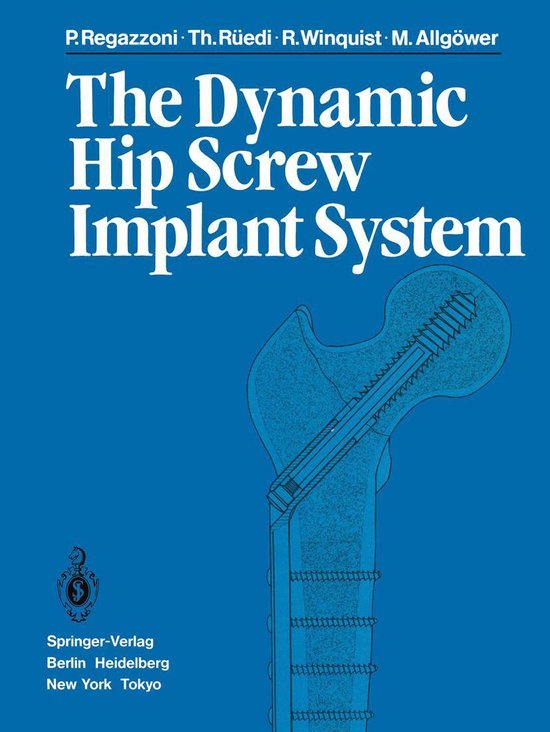 Medicine (R0) - The Dynamic Hip Screw Implant System - cover