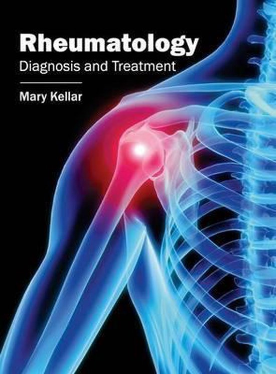 Rheumatology 9781632424372 Boeken
