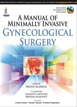 A Manual of Minimally Invasive Gynecological Surgery